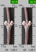 Acer negundo (klon jesionolistny)